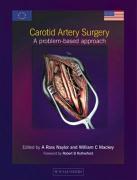 Carotid Artery Surgery