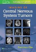 Imaging of Central Nervous System Tumors