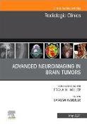 Advanced Neuroimaging in Brain Tumors, An Issue of Radiologic Clinics of North America