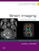 Brain Imaging: Case Review Series