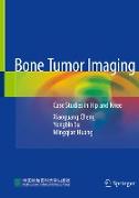 Bone Tumor Imaging