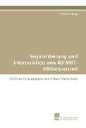 Segmentierung und Interpolation von 4D-MRT-Bildsequenzen