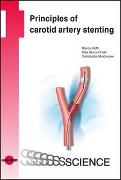 Principles of carotid artery stenting