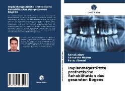 Implantatgestützte prothetische Rehabilitation des gesamten Bogens