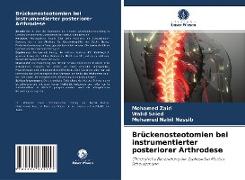 Brückenosteotomien bei instrumentierter posteriorer Arthrodese