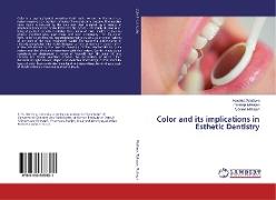 Color and its implications in Esthetic Dentistry