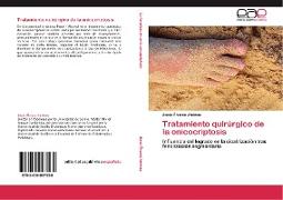 Tratamiento quirúrgico de la onicocriptosis