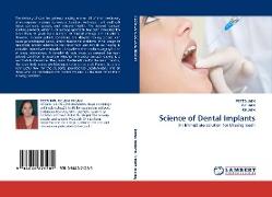 Science of Dental Implants