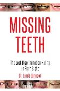 Missing Teeth