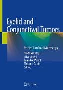 Eyelid and Conjunctival Tumors