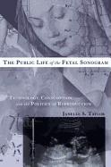 Public Life of the Fetal Sonogram: Technology, Consumption, and the Politics of Reproduction