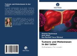 Tumore und Metastasen in der Leber