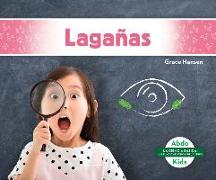 Lagañas (Eye Gunk)