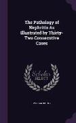 The Pathology of Nephritis As Illustrated by Thirty-Two Consecutive Cases