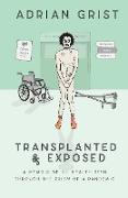 Transplanted & Exposed