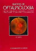 Guiones de oftalmología