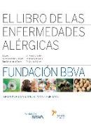 El libro de las enfermedades alérgicas