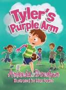 Tyler's Purple Arm