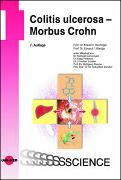 Colitis ulcerosa – Morbus Crohn