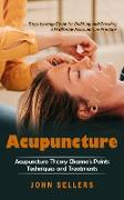 Acupuncture