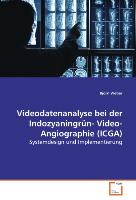 Videodatenanalysebei der Indozyaningrün-Video-Angiographie (ICGA)