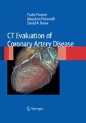 CT Evaluation of Coronary Artery Disease