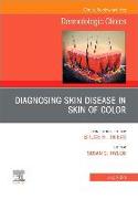 Diagnosing Skin Disease in Skin of Color, An Issue of Dermatologic Clinics