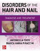 Disorders of the Hair and Nail: Diagnosis and Treatment