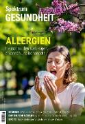 Spektrum Gesundheit - Allergien