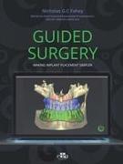 Guided Surgery