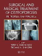 Surgical and Medical Treatment of Osteoporosis