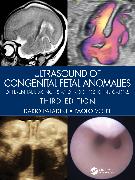 Ultrasound of Congenital Fetal Anomalies