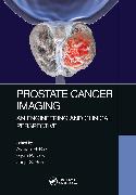 Prostate Cancer Imaging