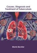 Causes, Diagnosis and Treatment of Tuberculosis