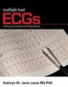 Multiple Lead ECGs: A Practical Analysis of Arrhythmias