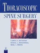 Thoracoscopic Spine Surgery