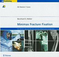 Minimax Fracture Fixation