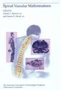 Spinal Vascular Malformations