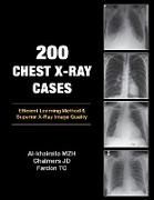 200 Chest X-Ray Cases