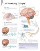 Understanding Epilepsy Laminated Poster