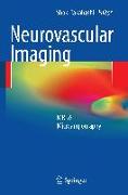 Neurovascular Imaging