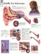 Middle Ear Infections Paper Poster