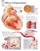Effects of Hypertension Paper Poster
