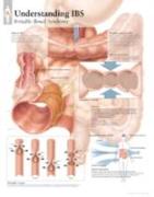 Understanding IBS Laminated Poster