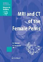 MRI and CT of the Female Pelvis