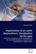 Implantation of an aortic bioprosthesis: Visualisation via the apex