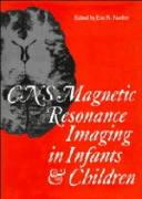 CNS Magnetic Resonance Imaging in Infants and Children